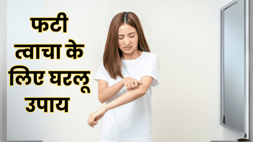 hath ki skin ka fatna? 3 घरेलू उपचार जो आपको फटी त्वचा से छुटकारा दिलाएंगे